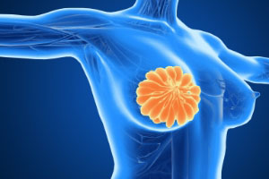 乳腺增生防治：身體發(fā)出的信號要注意！