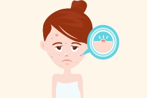 長痘痘了該怎么辦？怎樣護(hù)理才能更快恢復(fù)？