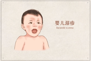 濕疹和蕁麻疹究竟有什么樣的差別呢？